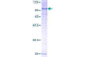 Image no. 2 for serum/glucocorticoid Regulated Kinase Family, Member 3 (SGK3) (AA 1-496) protein (GST tag) (ABIN1319829)
