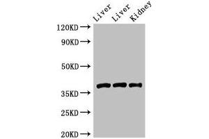 Western Blot Positive WB detected in: Rat liver tissue, Mouse liver tissue, Mouse kidney tissue All lanes: GNB4 antibody at 2 μg/mL Secondary Goat polyclonal to rabbit IgG at 1/50000 dilution Predicted band size: 38 kDa Observed band size: 38 kDa