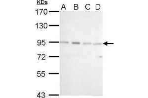 WB Image CSDE1 antibody [N2C1], Internal detects CSDE1 protein by Western blot analysis. (CDSE1 Antikörper  (Internal Region))