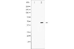 Western blot analysis of Smad2/3 phosphorylation expression in RAW264.