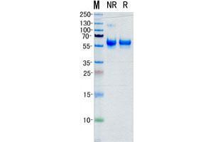 Western Blotting (WB) image for Matrix Metallopeptidase 1 (Interstitial Collagenase) (MMP1) (Transcript Variant 1) (Active) protein (His tag) (ABIN2726137)
