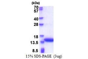 SDS-PAGE (SDS) image for Calponin 2 (CNN2) (AA 1-131) protein (His tag) (ABIN5853570)