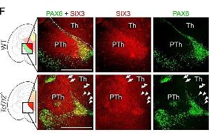 TCF7L2 controls the establishment of anatomical borders in the thalamus and habenula. (SIX3 Antikörper  (Internal Region))