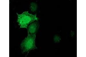 Anti-PNMT mouse monoclonal antibody (ABIN2454520) immunofluorescent staining of COS7 cells transiently transfected by pCMV6-ENTRY PNMT (RC206586). (PNMT Antikörper)