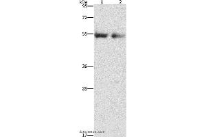 Western blot analysis of Human right lung and left lung cancer tissue, using ANGPT4 Polyclonal Antibody at dilution of 1:480 (Angiopoietin 4 Antikörper)