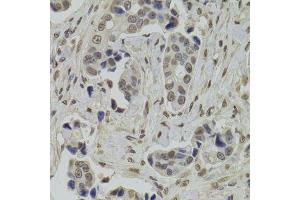 Immunohistochemistry (Paraffin-embedded Sections) (IHC (p)) image for anti-Integrator Complex Subunit 6 (INTS6) (AA 1-280) antibody (ABIN6142494)