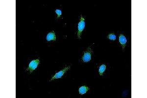 IF analysis of GAD65/GAD2 using anti-GAD65/GAD2 antibody (ABIN7603170). (GAD65 Antikörper  (N-Term))