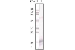 Western Blotting (WB) image for anti-Interferon gamma (IFNG) antibody (ABIN1107642) (Interferon gamma Antikörper)