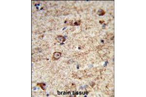 Formalin-fixed and paraffin-embedded human brain tissue reacted with LRRC4 Antibody , which was peroxidase-conjugated to the secondary antibody, followed by DAB staining. (LRRC4 Antikörper  (C-Term))