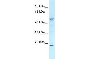 Western Blot showing Zfp113 antibody used at a concentration of 1. (Zfp113 Antikörper  (Middle Region))