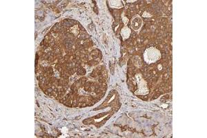 Immunohistochemical staining of human pancreas with DPYSL2 polyclonal antibody  shows cytoplasmic positivity in islet cells at 1:500-1:1000 dilution. (DPYSL2 Antikörper)
