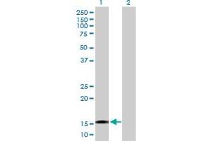 Western Blot analysis of TTC32 expression in transfected 293T cell line by TTC32 MaxPab polyclonal antibody. (TTC32 Antikörper  (AA 1-151))