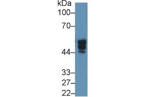 Rabbit Capture antibody from the kit in WB with Positive Control: Human 293T cell lysate.