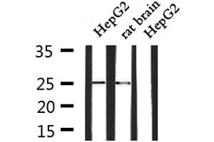 Western blot analysis of extracts from HepG2 and rat brain, using SOCS3 Antibody.