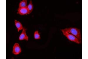 IF analysis of HIP1R using anti-HIP1R antibody (ABIN7601290).