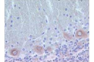 Rat brain zinc-fixed paraffin-embedded tissue (PKC delta Antikörper  (AA 114-289))