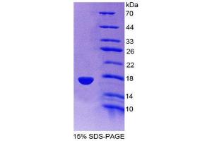 SDS-PAGE (SDS) image for Synuclein, gamma (Breast Cancer-Specific Protein 1) (SNCG) (AA 1-123) protein (His tag) (ABIN2126891) (SNCG Protein (AA 1-123) (His tag))