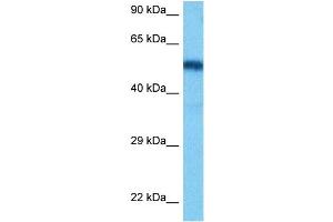 Host:  Rat  Target Name:  HNF1B  Sample Tissue:  Rat Liver  Antibody Dilution:  1ug/ml (HNF1B Antikörper  (N-Term))