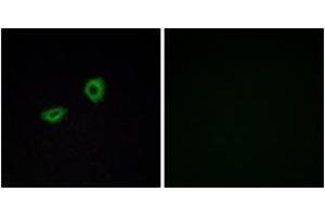 Immunofluorescence analysis of A549 cells, using CHRM5 Antibody. (CHRM5 Antikörper  (AA 281-330))