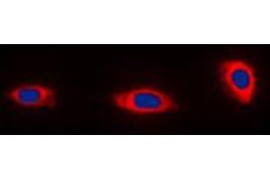Immunofluorescent analysis of NDUFA4 staining in HeLa cells.