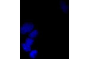 Immunofluorescence (IF) image for anti-Small Ubiquitin Related Modifier Protein 1 (SUMO1) (full length) antibody (FITC) (ABIN2452136)