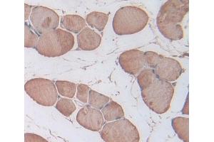 IHC-P analysis of skeletal muscle tissue, with DAB staining.