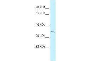 Host: Rabbit Target Name: PDLIM7 Sample Type: NCI-H226 Whole Cell lysates Antibody Dilution: 1. (PDLIM7 Antikörper  (N-Term))