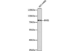 Western blot analysis of extracts of NCI-H460 cells, using BVES antibody (ABIN3020695, ABIN3020696, ABIN1512652 and ABIN6213674) at 1:1000 dilution. (BVES Antikörper  (AA 241-360))