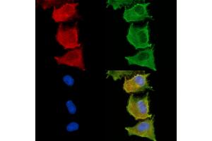 ABIN6263325 and ABIN6279013 staining  cells by IF/ICC. (MOGAT3 Antikörper  (C-Term))