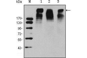 Western blot analysis using KI67 mouse mAb against Hela (1), MCF-7 (2) and Raji (3) cell lysate. (Ki-67 Antikörper)