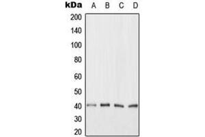 Western blot analysis of ANKRD1 expression in HeLa (A), Jurkat (B), NIH3T3 (C), H9C2 (D) whole cell lysates. (ANKRD1 Antikörper  (C-Term))