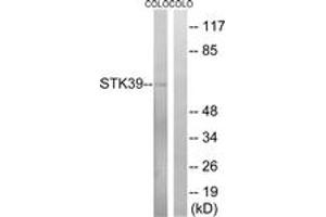 Western blot analysis of extracts from COLO cells, using STK39 (Ab-325) Antibody.