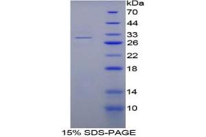 SDS-PAGE analysis of Mouse Fibrinogen alpha Protein. (FGA Protein)