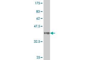 Western Blot detection against Immunogen (39. (SMAD3 Antikörper  (AA 147-270))