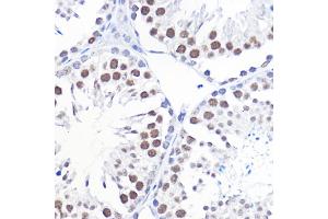 Immunohistochemistry (IHC) image for anti-General Transcription Factor IIB (GTF2B) (AA 50-150) antibody (ABIN7267370)