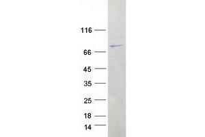 Validation with Western Blot (LRRC40 Protein (Myc-DYKDDDDK Tag))