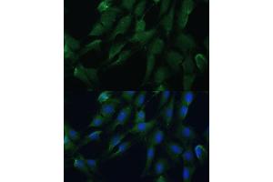 Immunofluorescence analysis of C6 cells using DRG2 antibody (ABIN7266746) at dilution of 1:100. (DRG2 Antikörper  (AA 150-260))