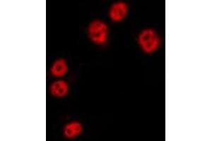 ABIN6275330 staining HepG2 by IF/ICC. (NOL10 Antikörper  (C-Term))
