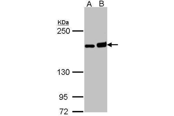 DIAPH1 Antikörper  (C-Term)