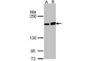 WB Image Sample (30 ug of whole cell lysate) A: H1299 B: Raji 5% SDS PAGE antibody diluted at 1:1000 (DIAPH1 Antikörper  (C-Term))