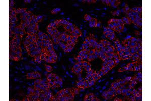 Immunofluorescence (IF) image for anti-Receptor tyrosine-protein kinase erbB-2 (ErbB2/Her2) (C-Term) antibody (ABIN7448962) (ErbB2/Her2 Antikörper  (C-Term))