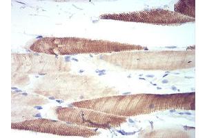 Immunohistochemistry (IHC) image for anti-Autophagy Related 13 (ATG13) (AA 339-550) antibody (ABIN5542701)