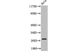Western Blot analysis of HeLa cells using Cleaved-Integrin α6 LC (E942) Polyclonal Antibody (ITGA6 Antikörper  (Cleaved-Glu942))