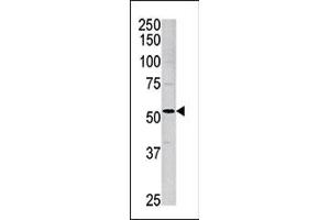 Western blot analysis of anti-ACVR1 Pab (ABIN391156 and ABIN2841266) in mouse brain tissue lysate. (ACVR1 Antikörper  (AA 85-123))