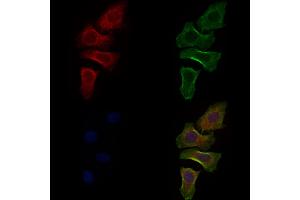 ABIN6261932 and ABIN6277595 staining Hela cells by IF/ICC. (GDI1 Antikörper  (Internal Region))