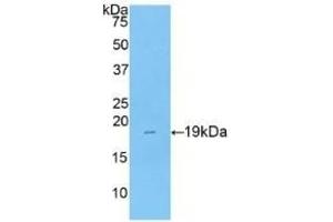 Detection of Recombinant COL8a1, Rat using Polyclonal Antibody to Collagen Type VIII Alpha 1 (COL8a1) (COL8A1 Antikörper  (AA 590-744))