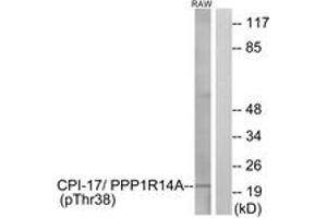 Western Blotting (WB) image for anti-Protein Phosphatase 1, Regulatory (Inhibitor) Subunit 14A (PPP1R14A) (pThr38) antibody (ABIN2888390) (CPI-17 Antikörper  (pThr38))
