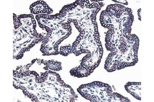 Immunohistochemistry (Paraffin-embedded Sections) (IHC (p)) image for anti-Receptor Tyrosine-Protein Kinase ErbB-3 (ERBB3) antibody (ABIN967437)