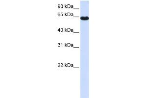 WB Suggested Anti-ZNF117 Antibody Titration:  0.