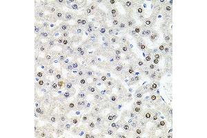 Immunohistochemistry of paraffin-embedded rat liver using U2SURP antibody (ABIN6132839, ABIN6149759, ABIN6149760 and ABIN6220240) at dilution of 1:100 (40x lens). (SR140 Antikörper  (AA 705-1029))
